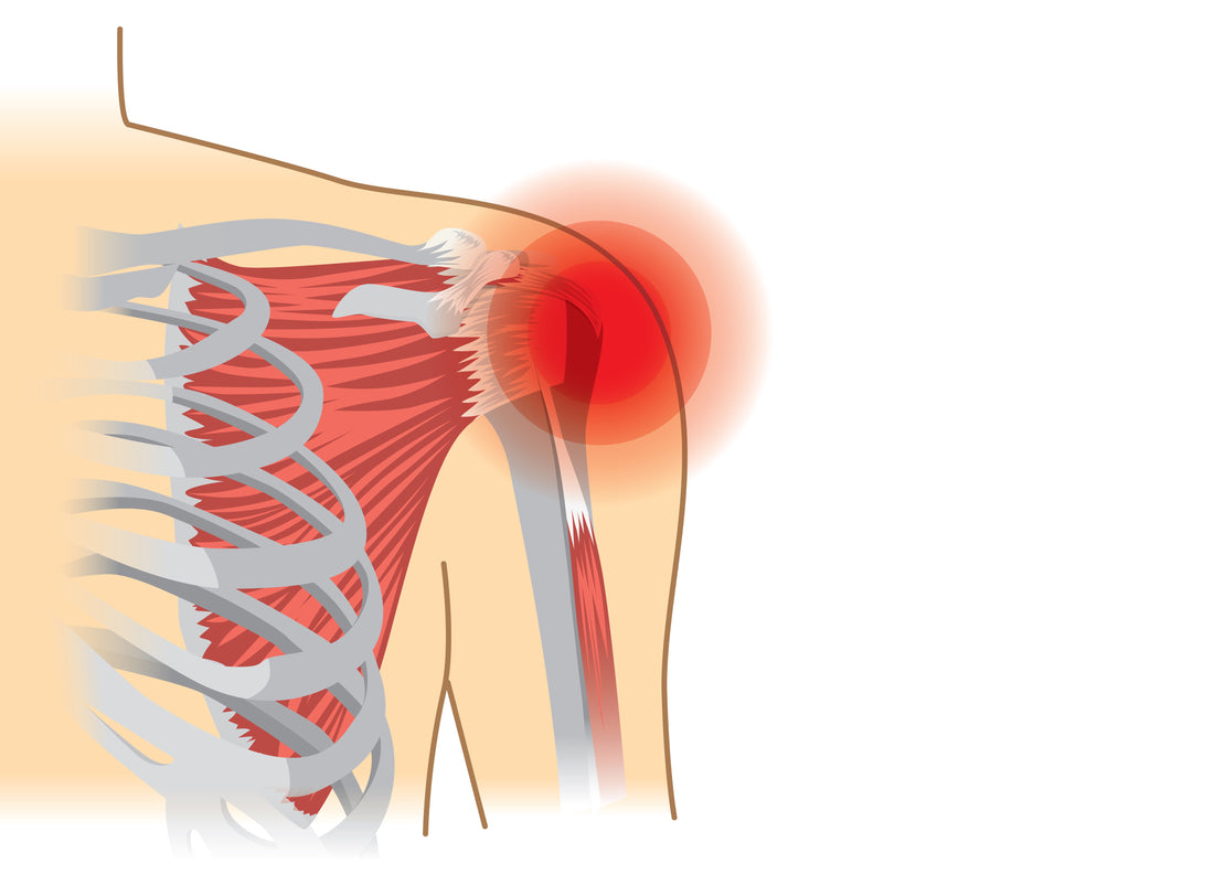 shoulder pain image xray